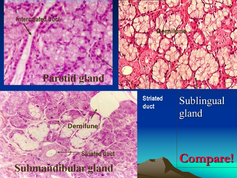 sublingual  gland Submandibular gland Striated duct demilune Demilune Intercalated duct Parotid gland Sublingual